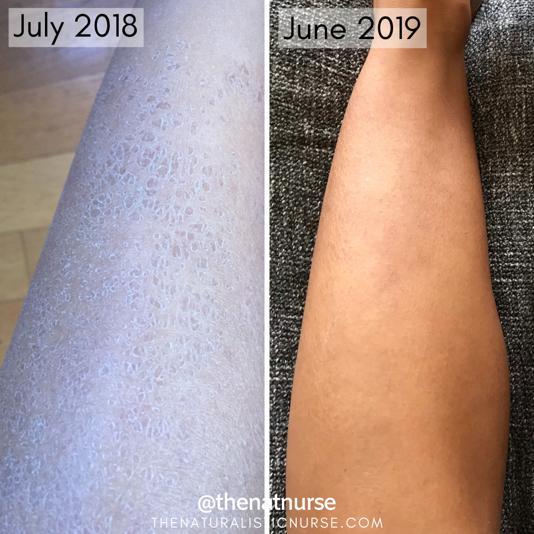 Progress legs 2.png