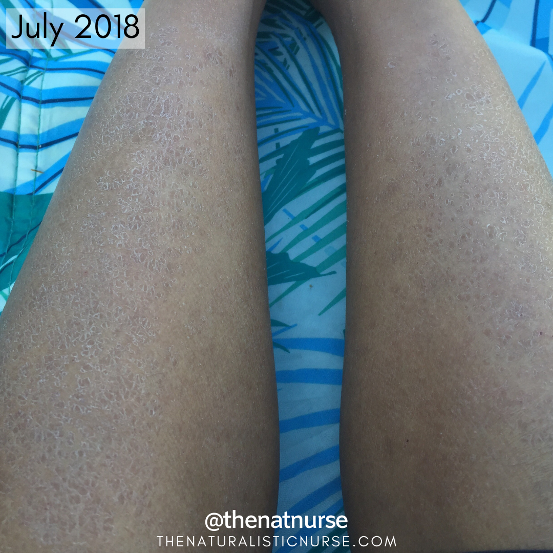 Progress legs 3.png