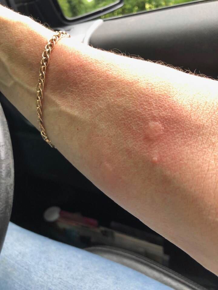 Stings.jpg