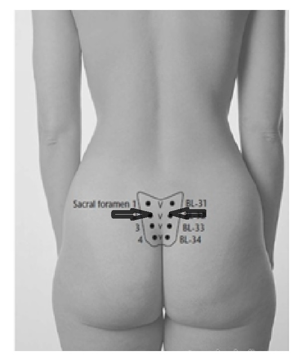 lower-back-acupressure-points-image.png