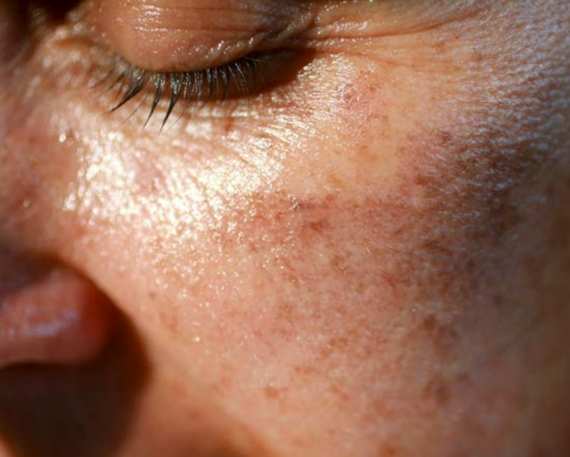 Radiant Skin Now. Pay Later
