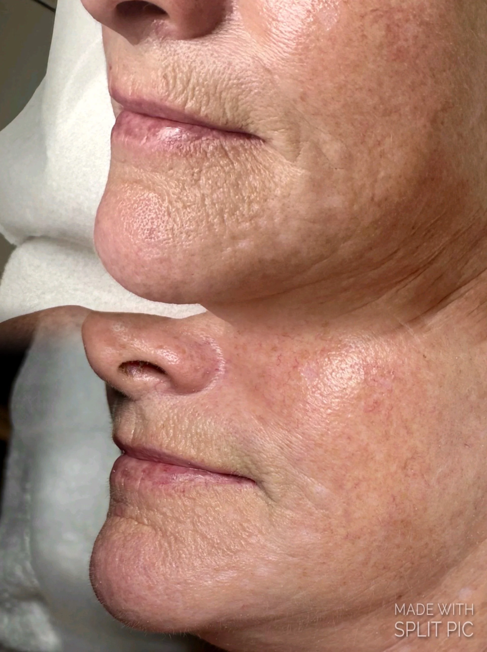 cameraRollTempImage (3).JPG