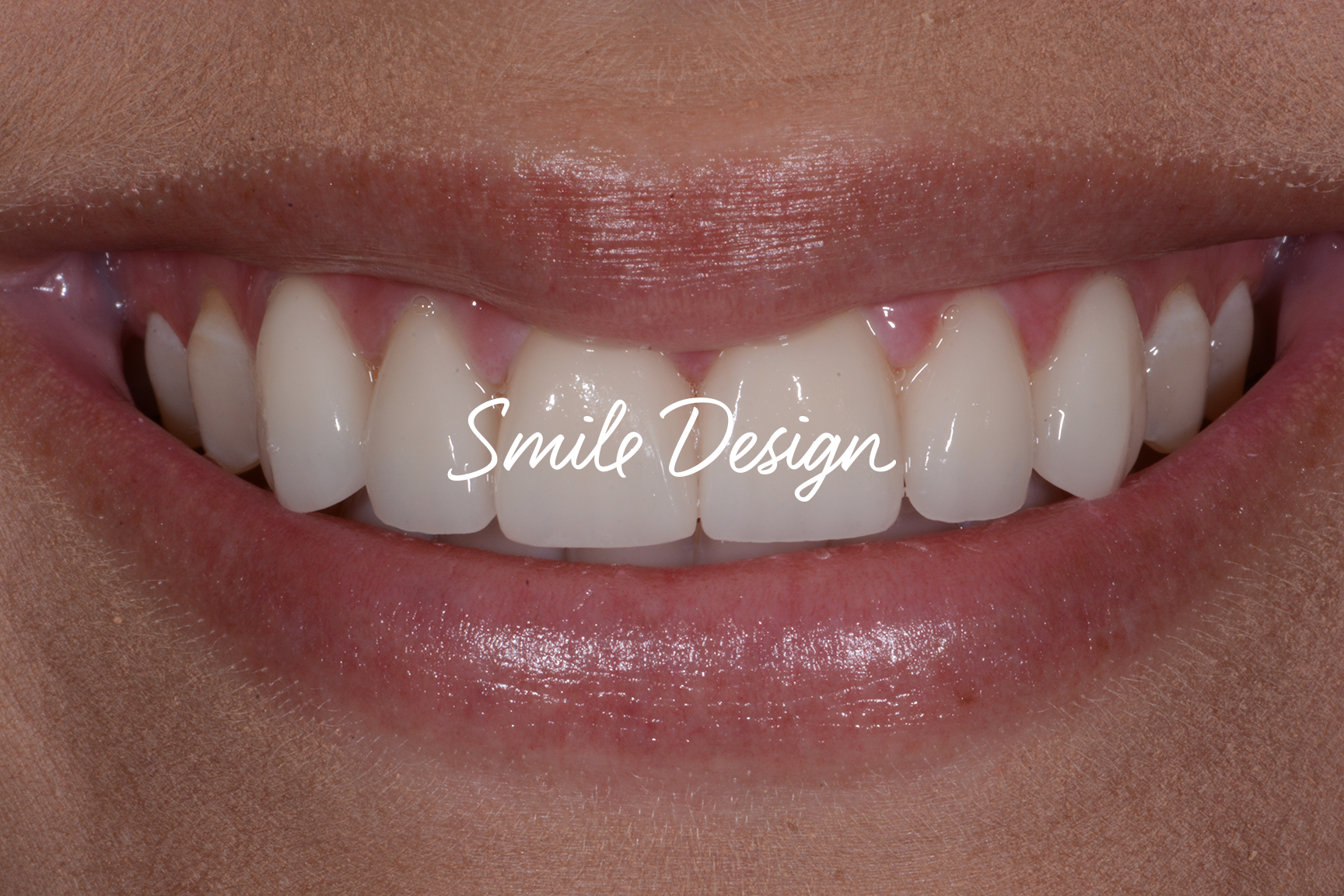 Smile Design-smtext-web.png