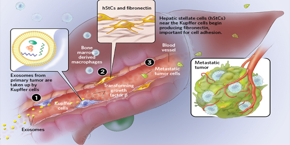 CANCER’S VANGUARD
