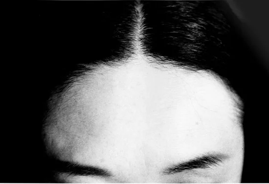 woman forehead