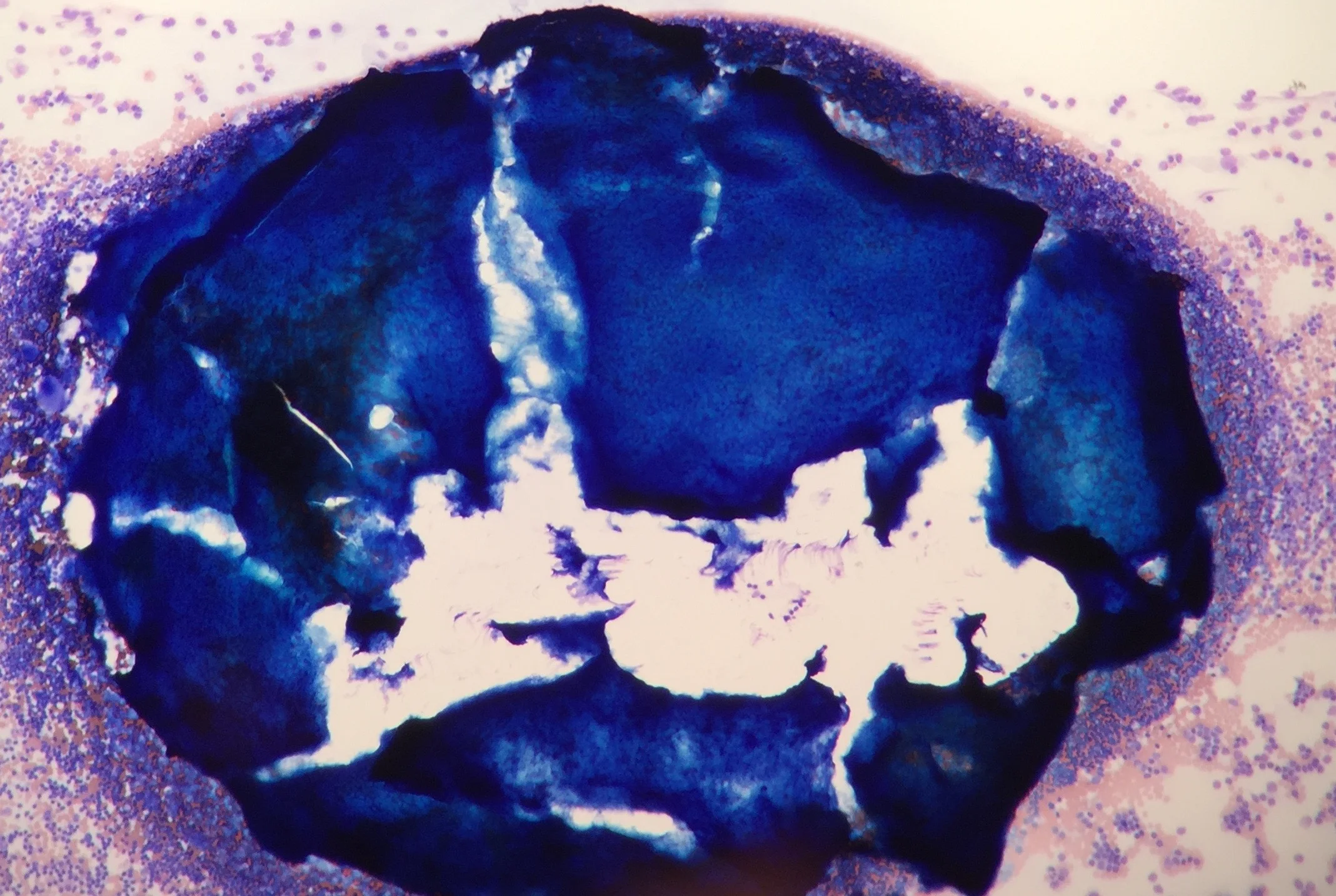 Hypercellular particle.jpg