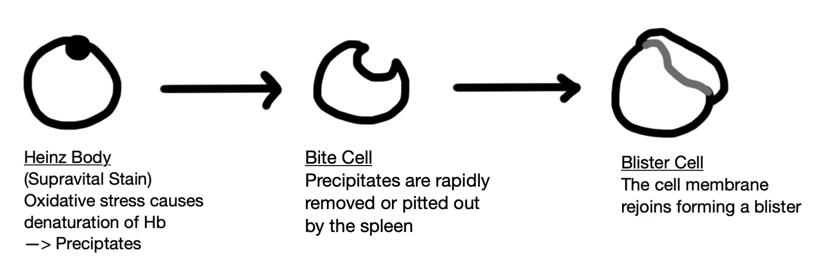 oxidative haemolysis.jpg