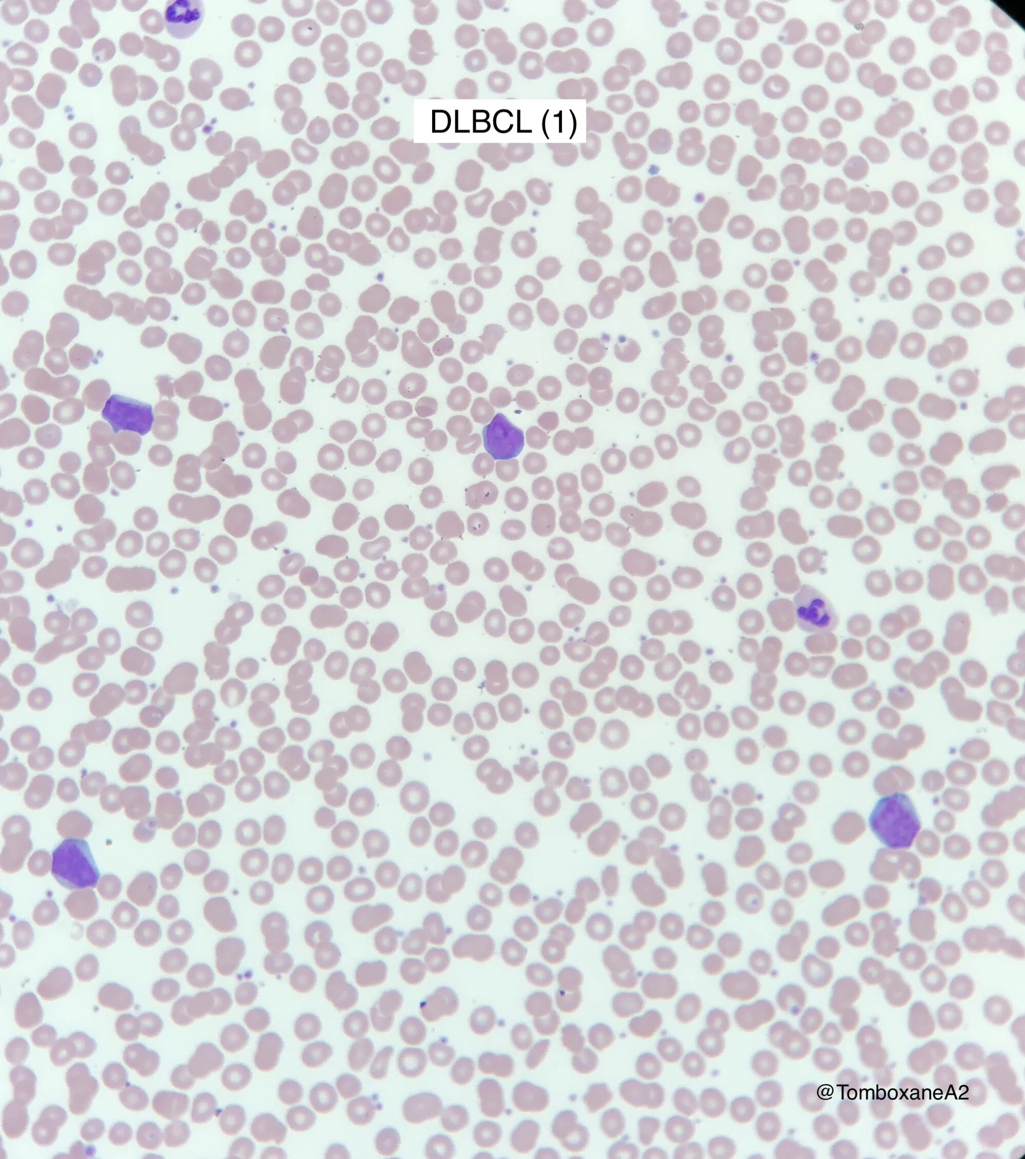 Peripheral Blood HaemBase Peripheral Blood HaemBase