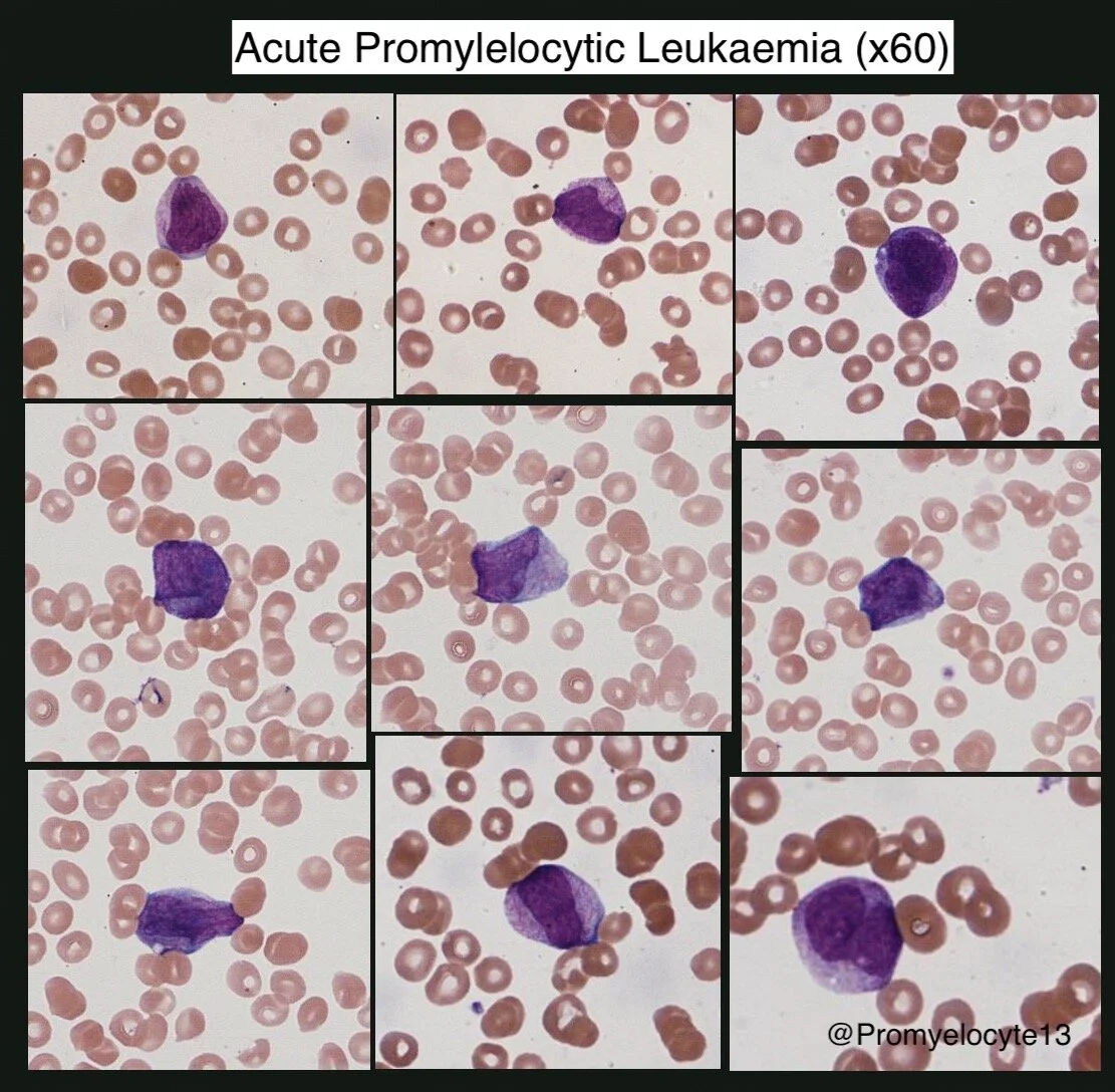APML — HaemBase
