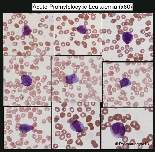 APML — HaemBase