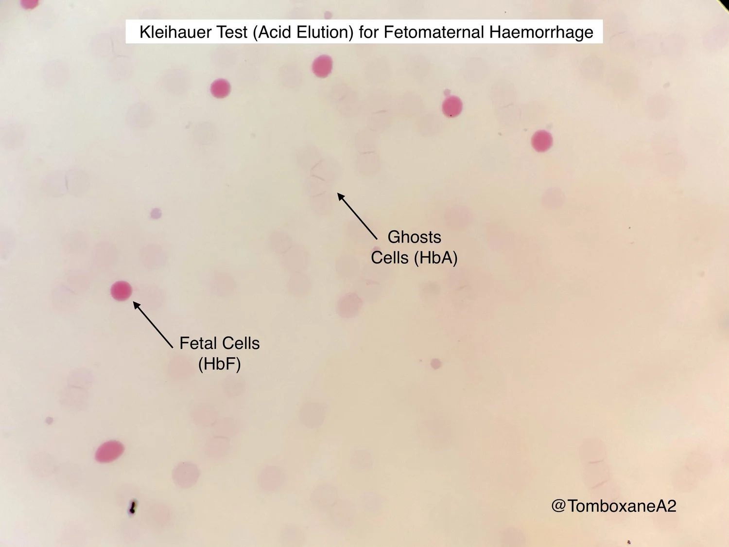 FMH Estimation — HaemBase