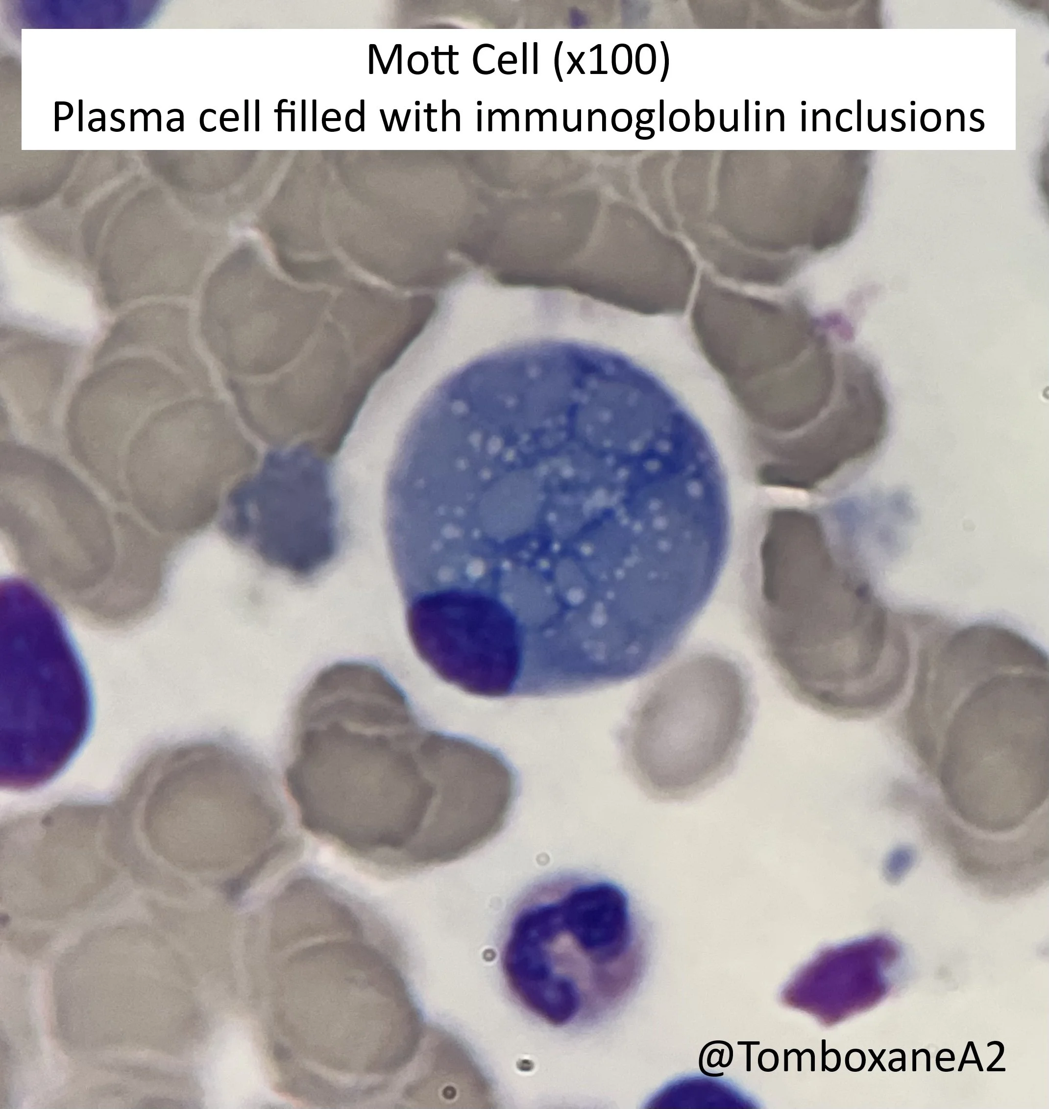 Mott cell.jpeg