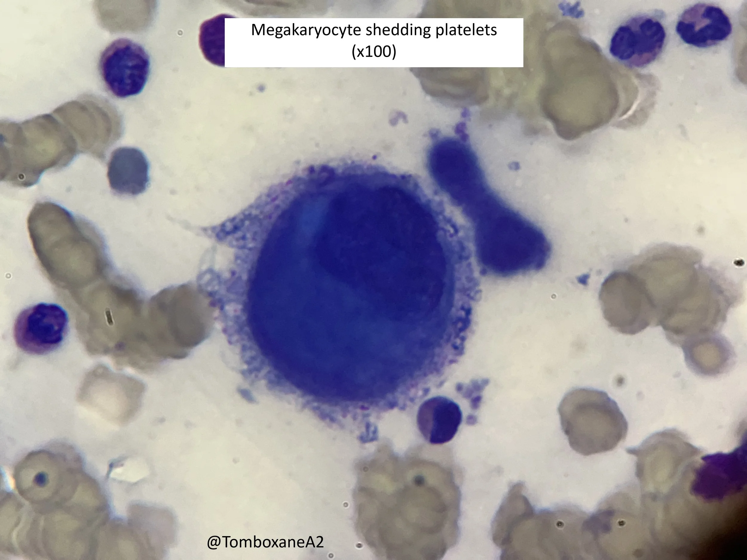 Megakaryocyte shedding platelets.jpeg