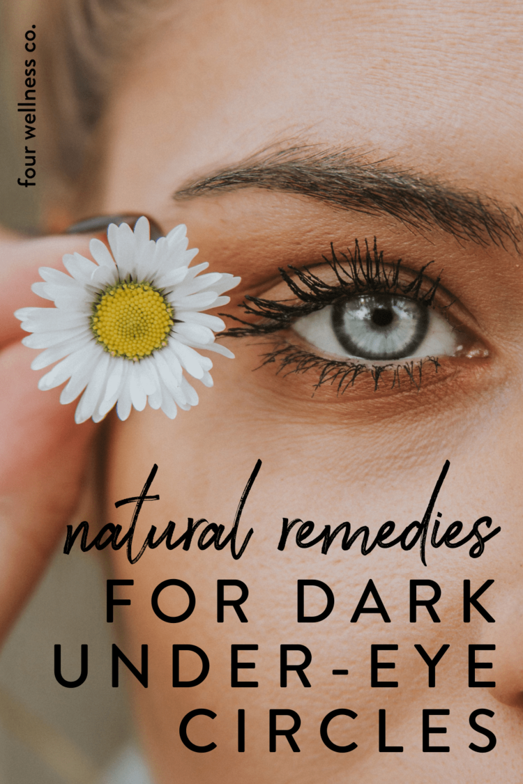 Natural Remedies for Dark Under-eye Circles //  Four Wellness Co. wellness blog, healthy living tips and resources from an integrative nutrition health coach
