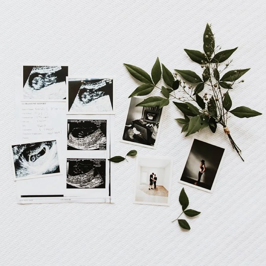 I_had_a_miscarriage_story_pregnancy_pregnant_kandis_marino_photography