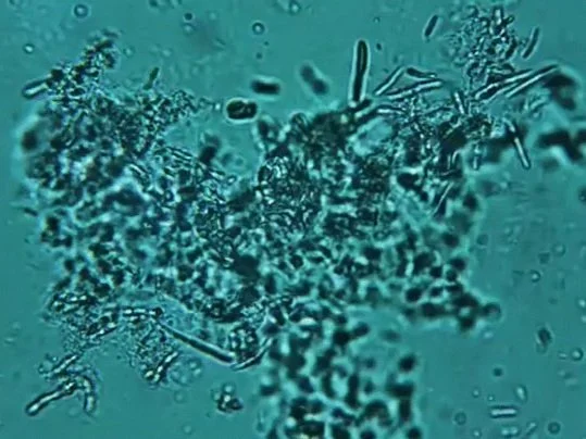 Antarctic Microbes Put Survival Life Potential Breakthroughs in Materials Science