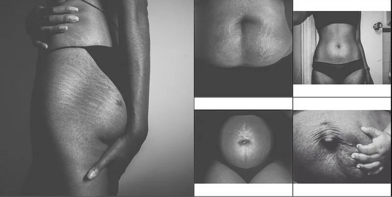 spiritual meaning behind stretch marks