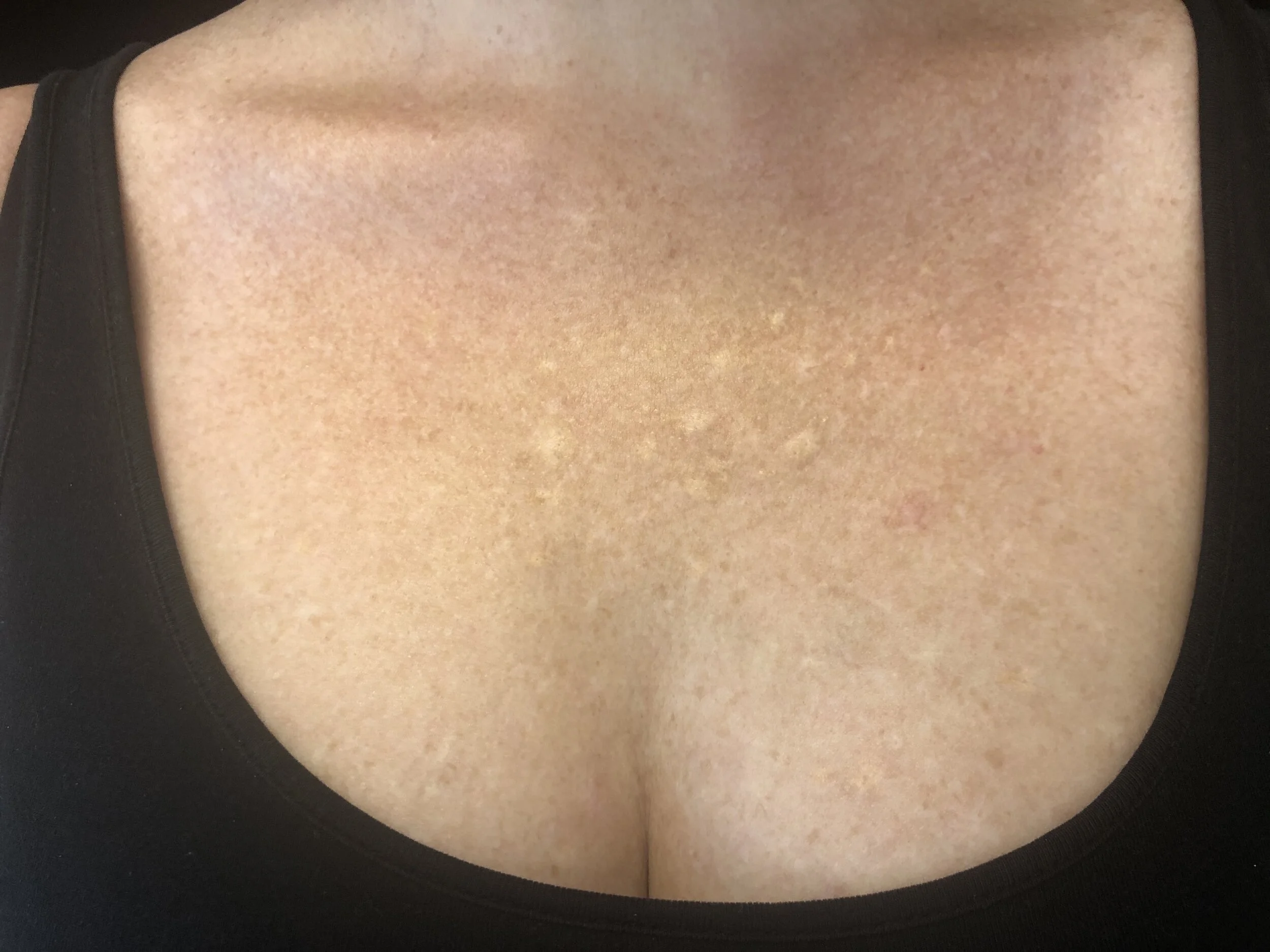 After her first session, her skin barely took the ink.