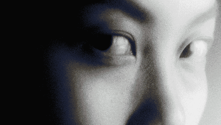 Document Global Reel A