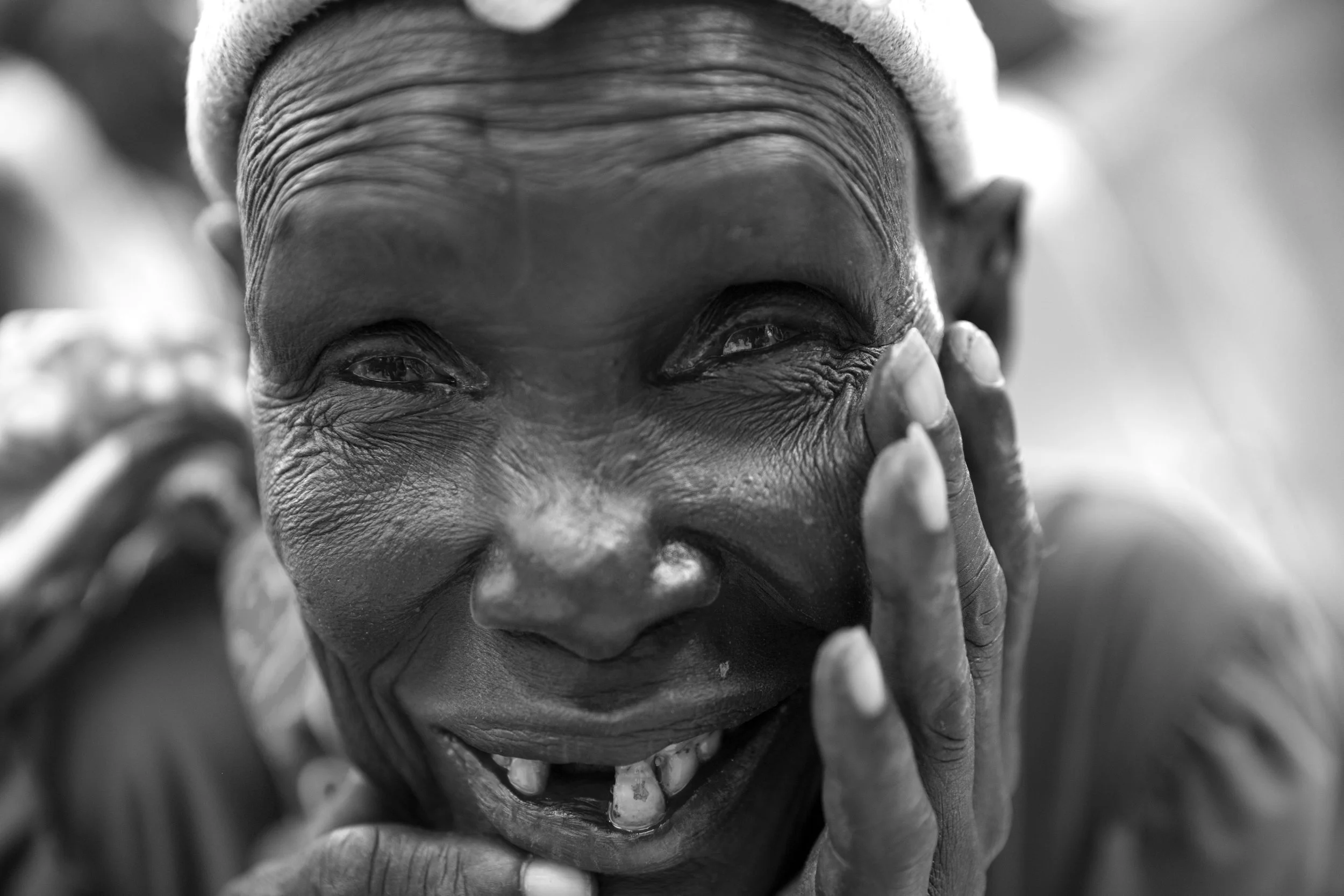 20170719 HospitalPatientsBentiu_0024.jpg