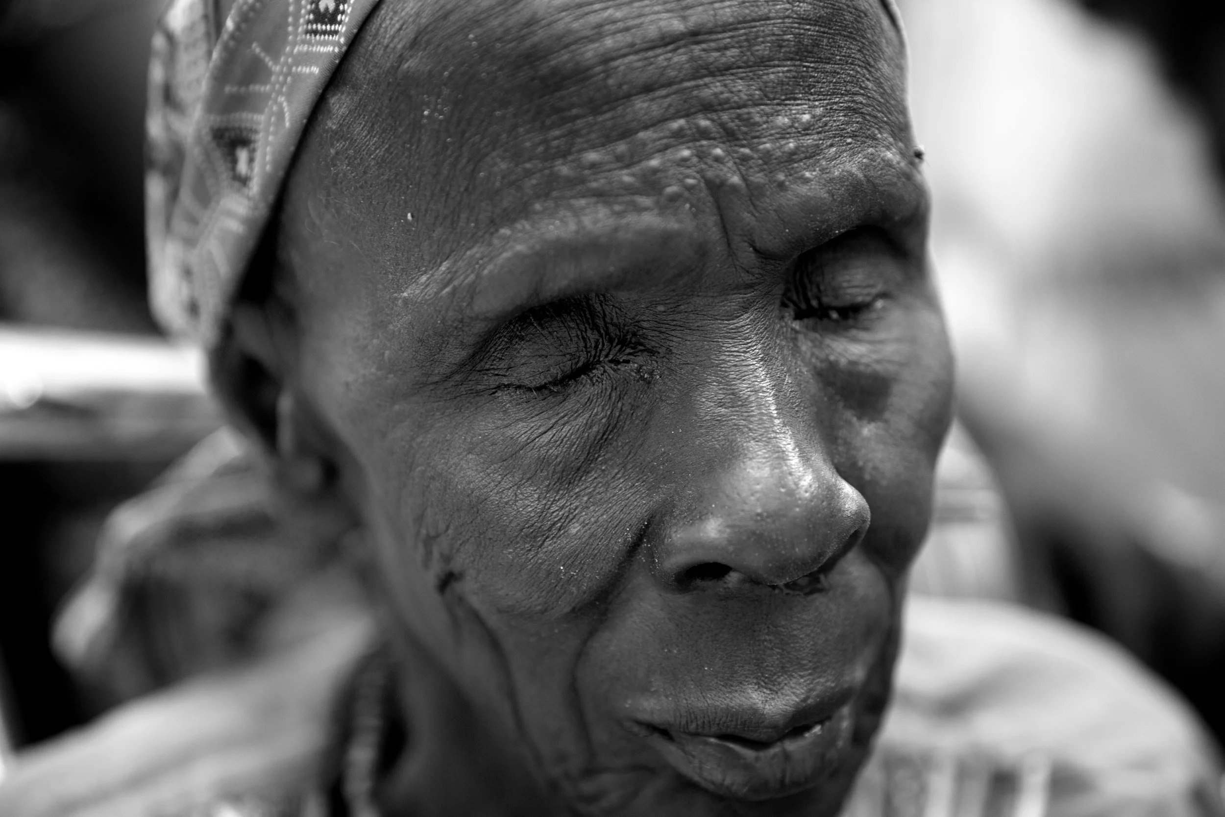 20170719 HospitalPatientsBentiu_0026.jpg