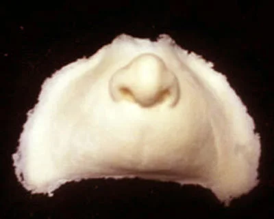 whonoseM.jpg
