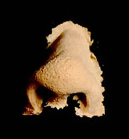 oldnose.jpg