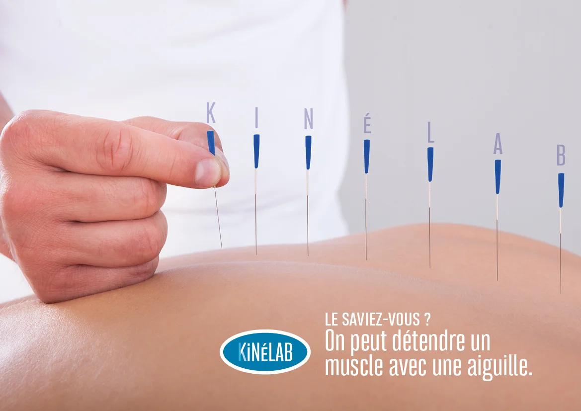 le saviez-vous : On peut détendre un muscle avec une aiguille !