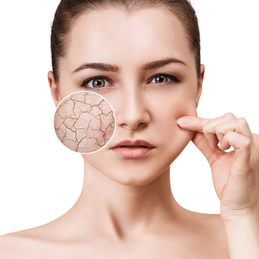 Dehydrated or Dry Skin What is the difference? — Midwest Laser Centre