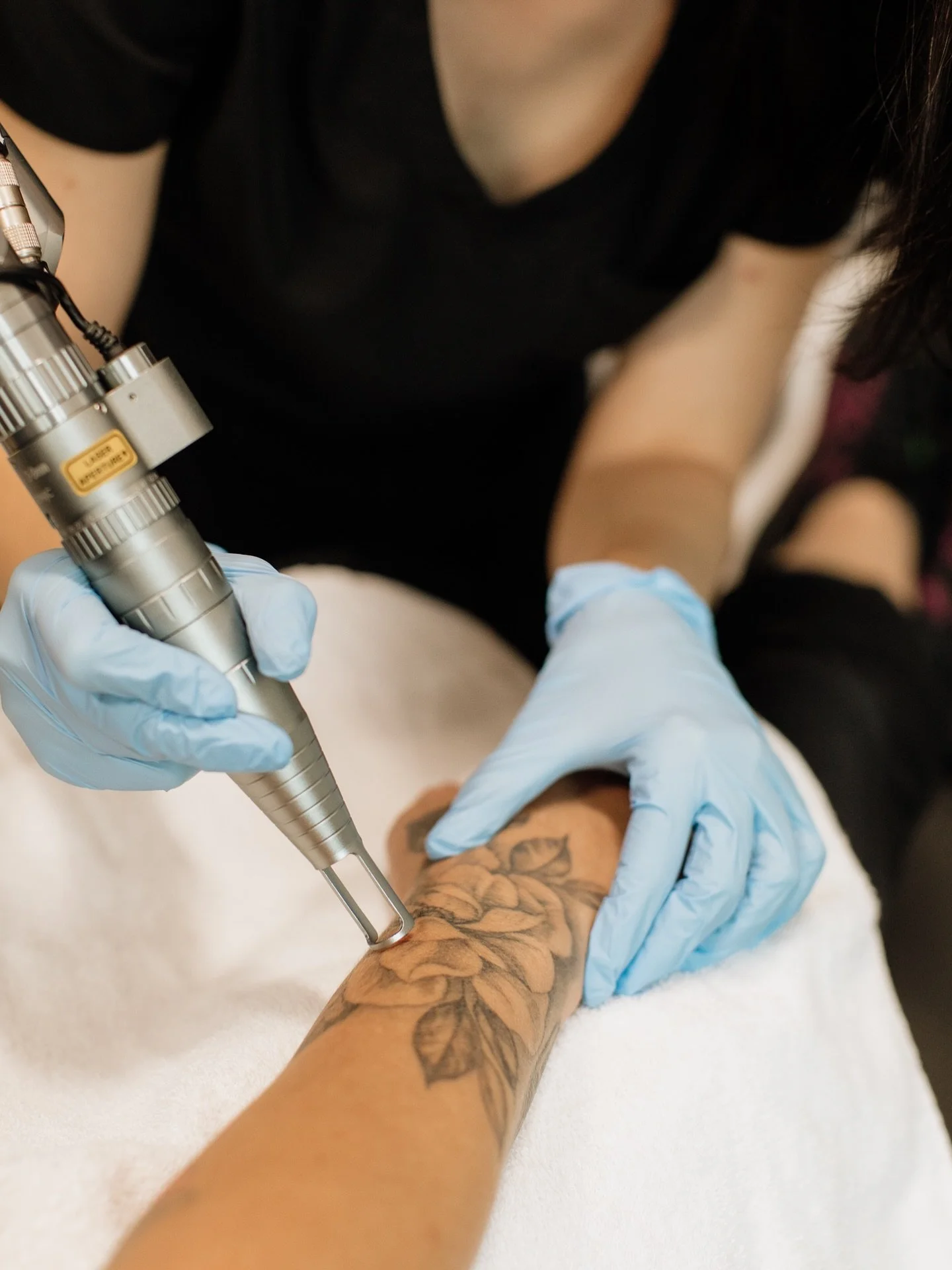 Ever wondered how laser treatments fade tattoos? Imagine tattoo ink as massive boulders in your skin. We need our immune system's Pac-Man cells to absorb them, but they're too large without laser help. The laser acts like a sledgehammer, using heat b