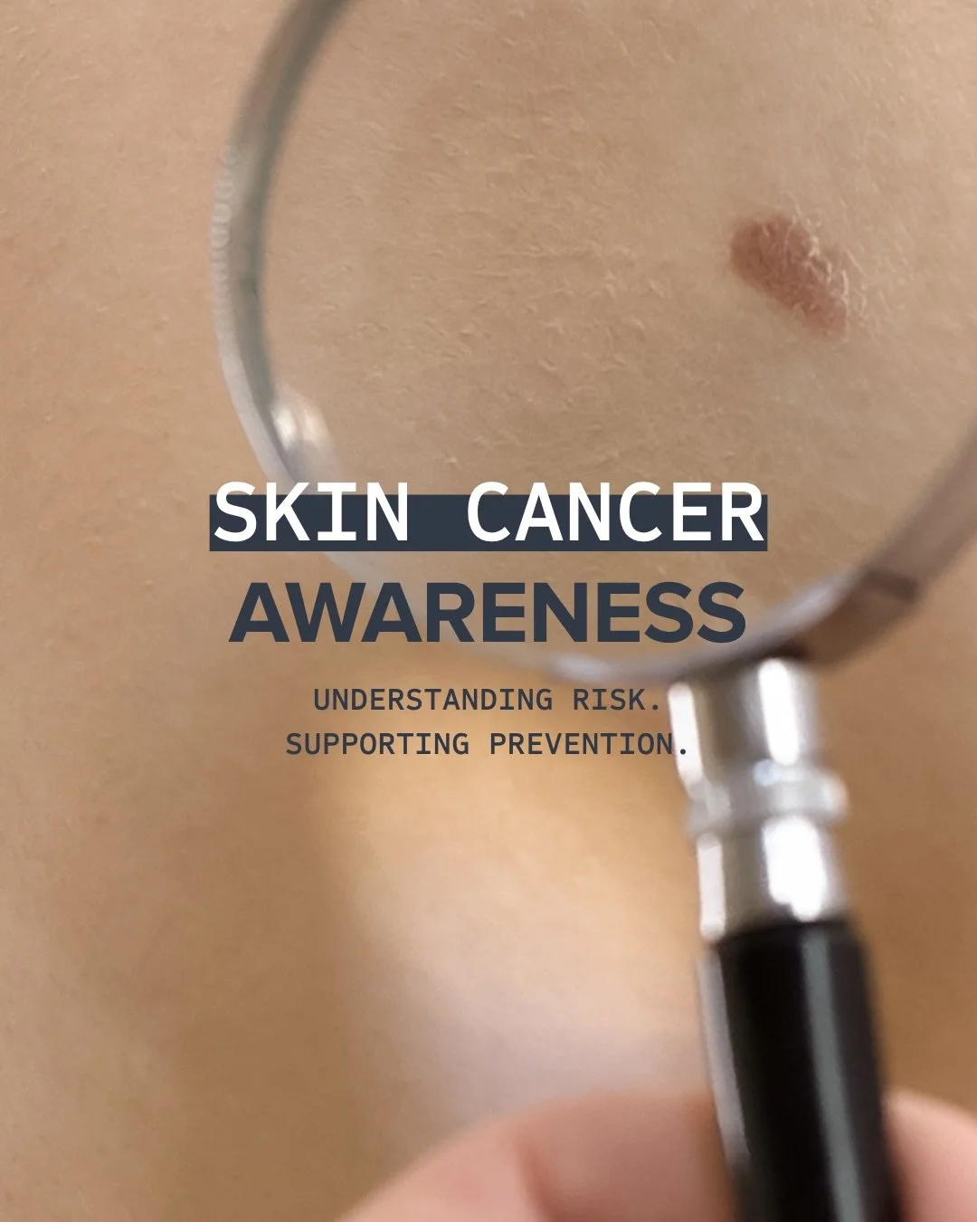 It&rsquo;s important to be aware of Oxidative Stress and the effects it has on your skin. Ensuring you are using a sunscreen with broad spectrum protection with an SPF rating of 30+ (and do not forget to re-apply) will help your skin more than you th