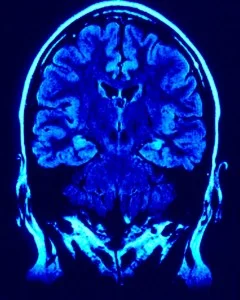 brain-240x300.jpg