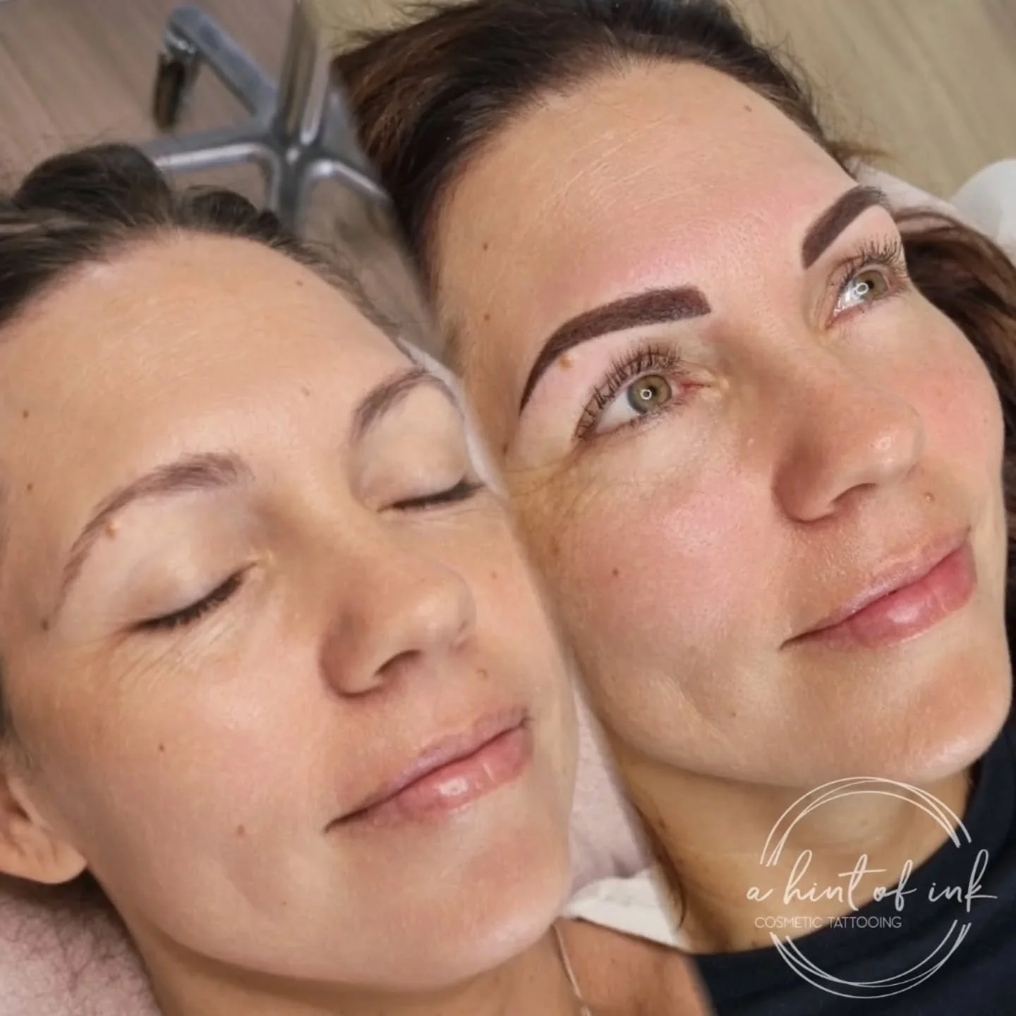 We feel so privileged working on beautiful faces like this one 😍

These brows will soften and blend in beautifully with her natural eyebrows when healed 👌