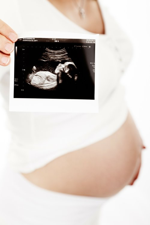Ultrasound scan basics for clinicians