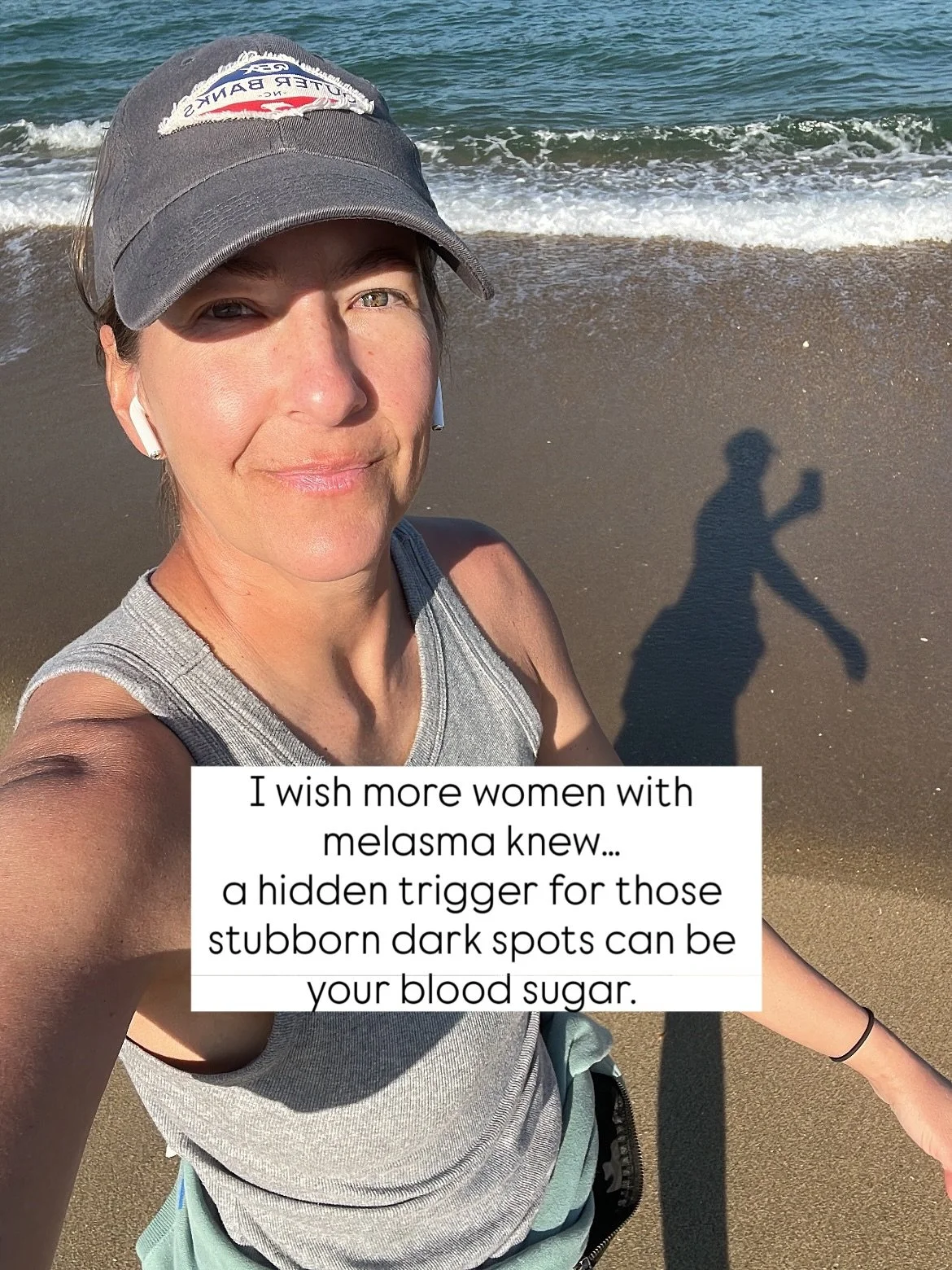 I wish I&rsquo;d known this when I first developed melasma.

Back then, I thought it was only about sun and hormones. No one ever told me that blood sugar imbalances could actually feed melasma by driving up insulin and stimulating pigment cells.

Wh