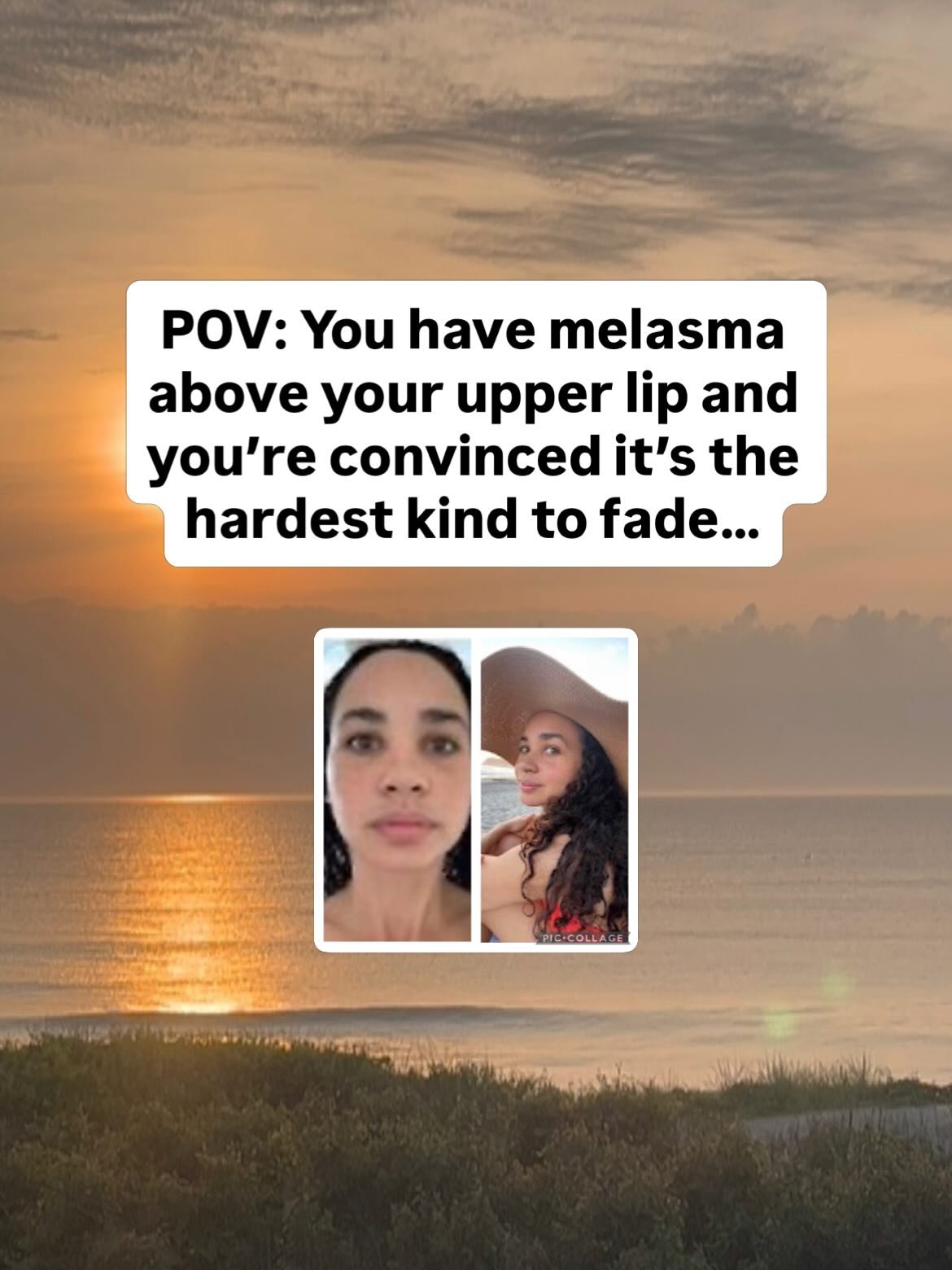 Melasma is definitely a stubborn skin condition. But where it shows up on your face doesn&rsquo;t determine how hard it is to fade.

Upper lip. Cheeks. Forehead.

The location doesn&rsquo;t make it more permanent. It doesn&rsquo;t mean it will take l