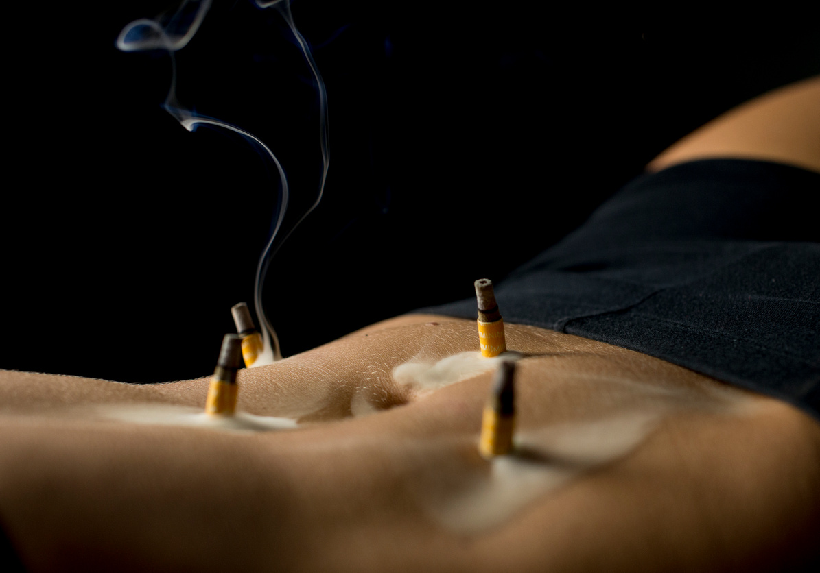 acupuncture-134-(ZF-2514-84741-1-009).jpg