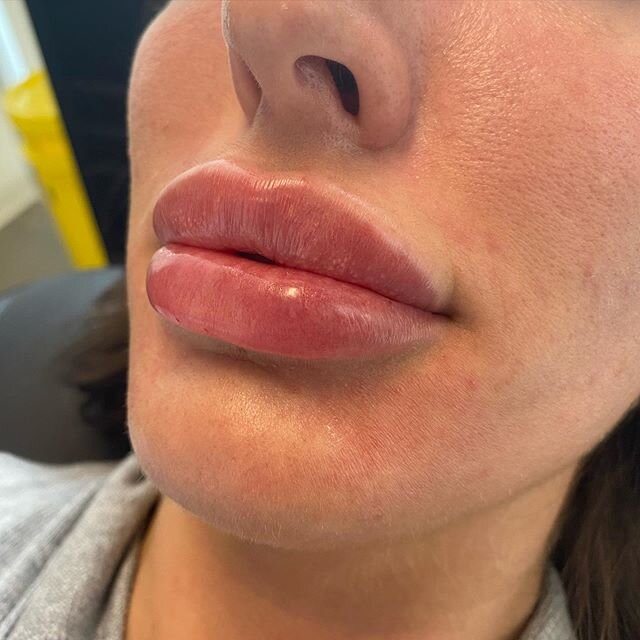 Lip touch up on this beautiful babe❤️