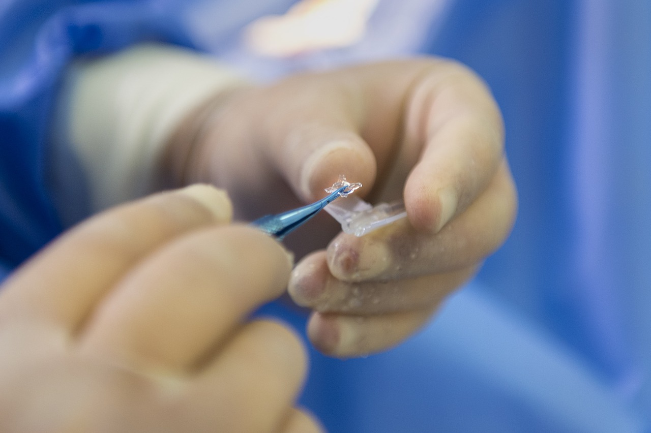 Medicine-Eye-Surgery-Surgery-Human-Treatment-3262293.jpg