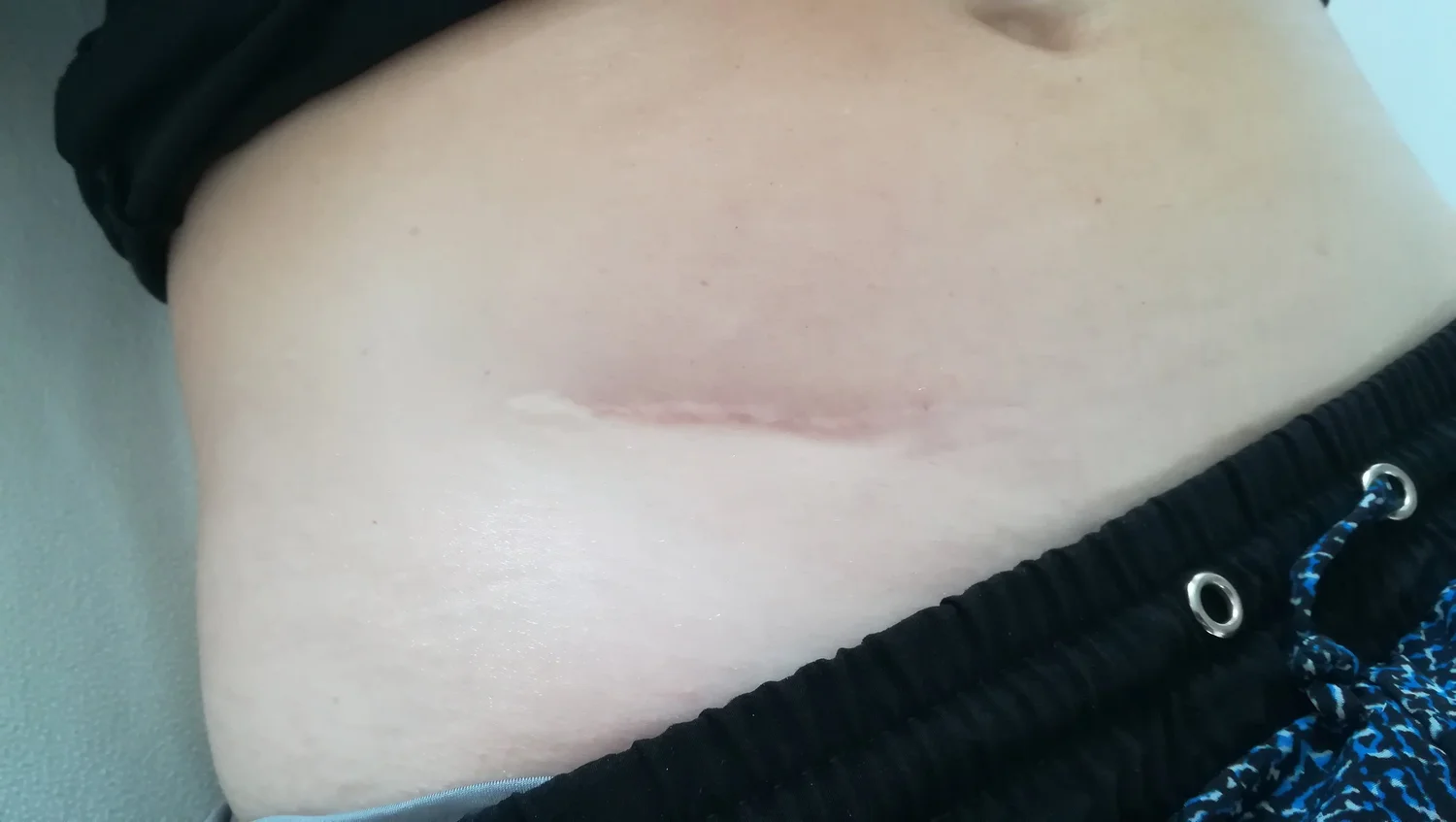 Results And Testimonials The Massage Practice