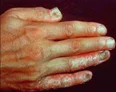 hand.jpg