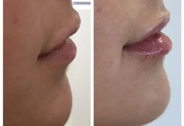 lip.jpg