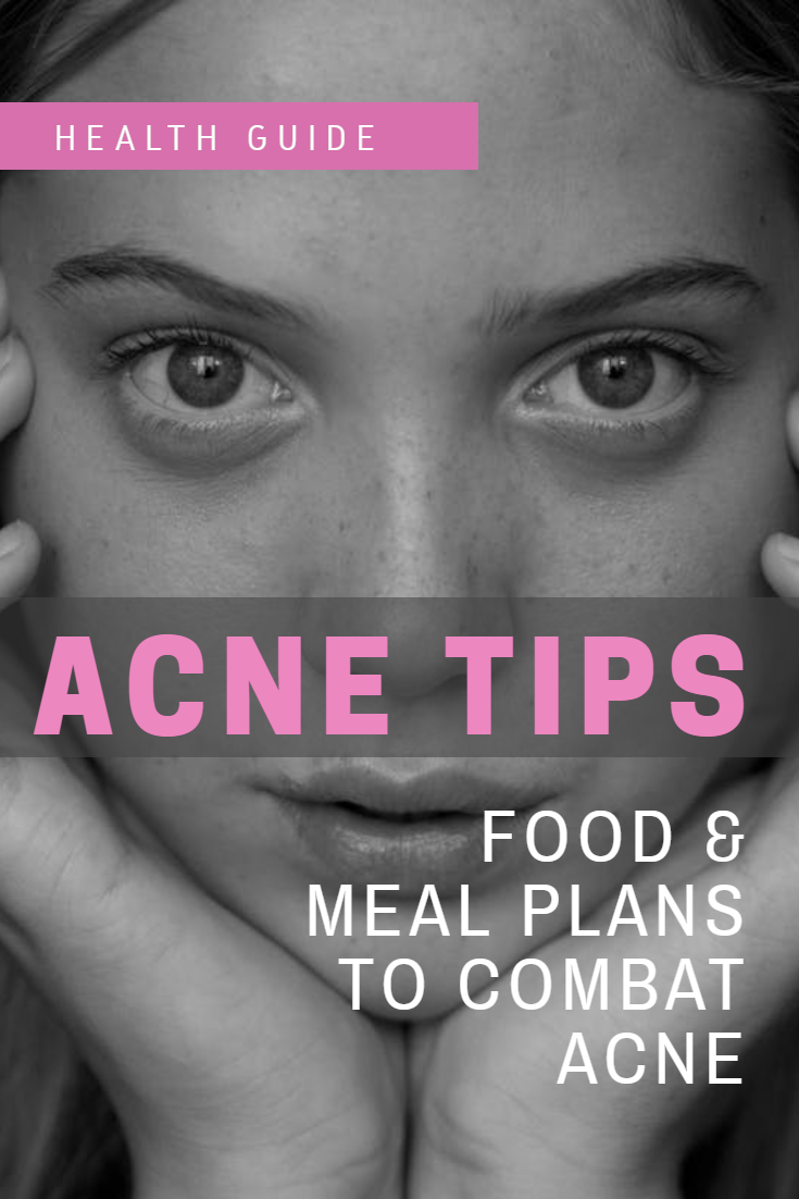 acne-tips-Pinterest-pin.png