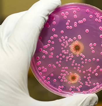 petri dish germs.jpg