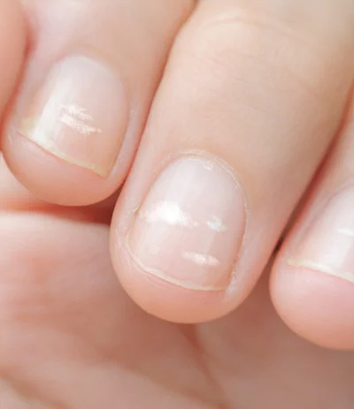 fingernails.jpg