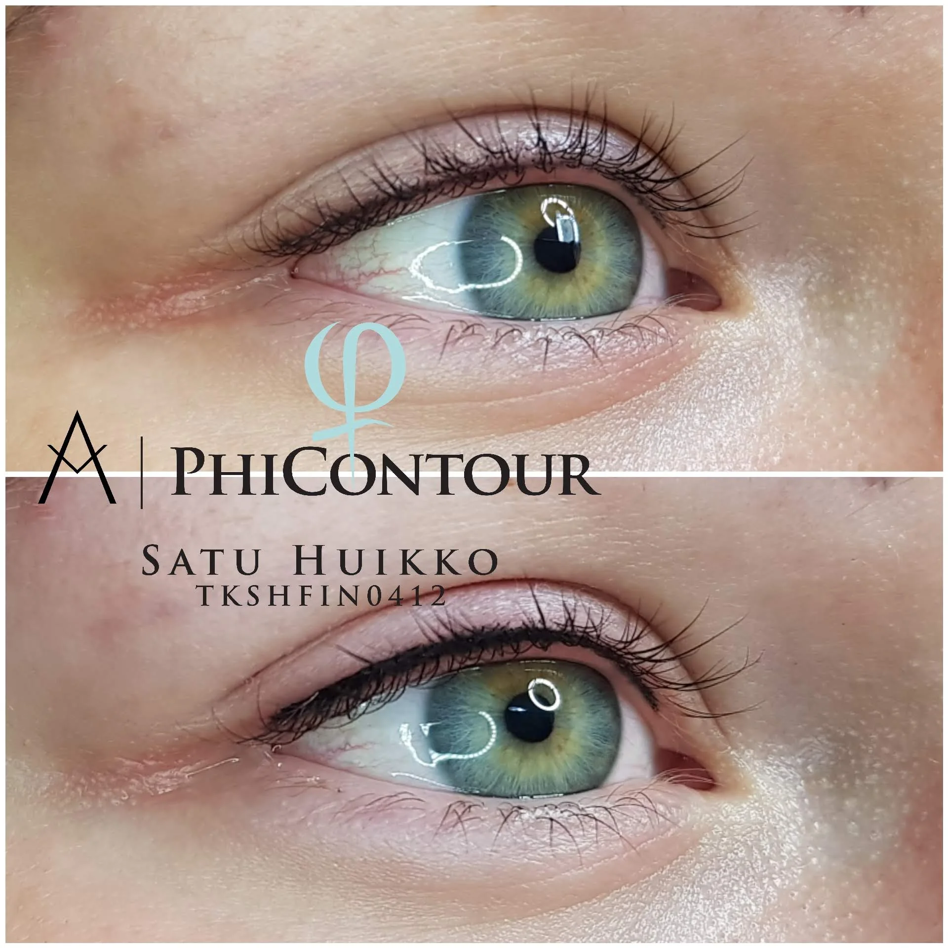 Silmänrajauspigmentointi yläluomella ennen jälkipigmentointia ja heti jälkipigmentoinnin jälkeen. Luonnollinen eyeliner pigmentointi korostaa kauniisti silmän muotoa myös heti käsittelyn jälkeen. Mitä paksumpi rajaus tehdään, sitä enemmän silmäluomi yleensä turpoaa.
