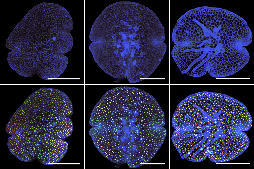Marchantia gemma, showing direct visualisation of gene expression through multiple nuclear-localised fluorescent protein gene fusions . (Images: Bernardo Pollak & Mihails Delmans)