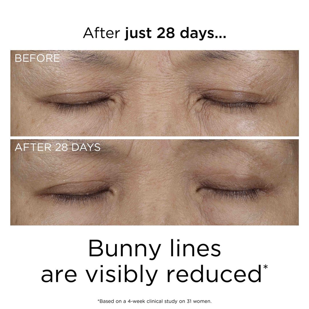 pdp-a0134473-prevage-reset-serum-10-before-after.jpg