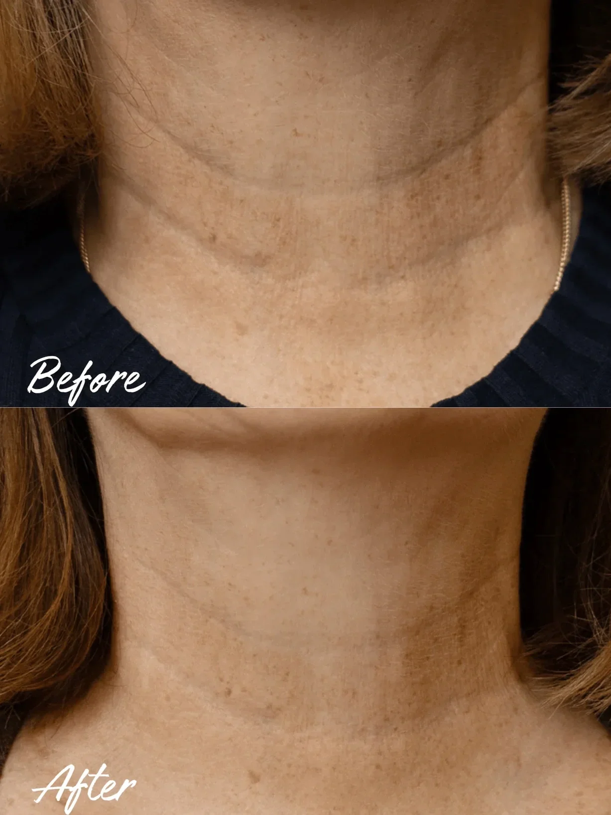 boost-lab-moisturiser-pro-lift-neck-decolletage-cream-1226709878.webp