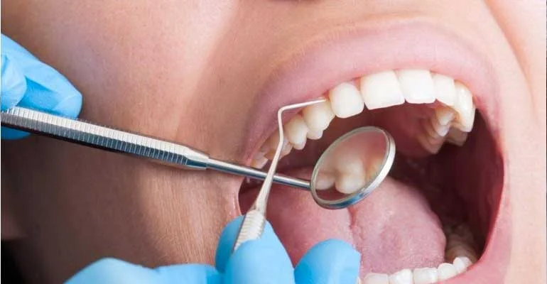 tooth-4.jpg